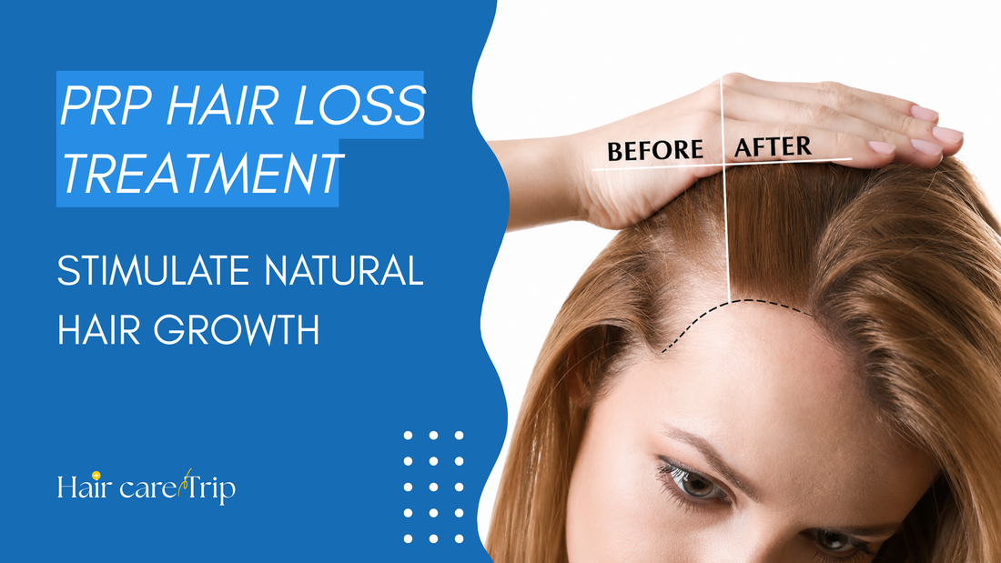 hair-care-trip-prp-hair-loss-treatment-1