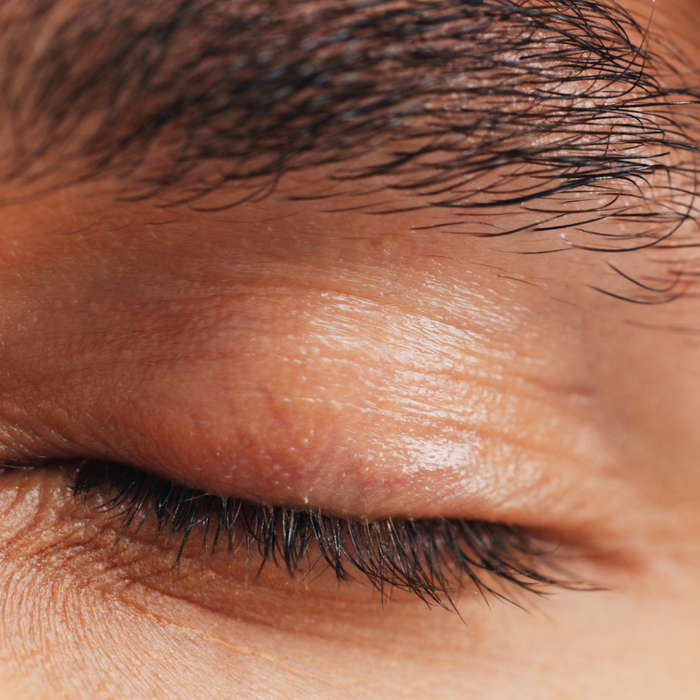 Eyebrow Transplant Deposit