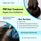 PRP Hair Treatment Service