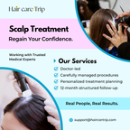 Scalp Treatment Service